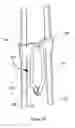 Fig. 11 - Folding wire easel