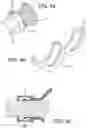 Fig. 07 - VENTING DEVICE
