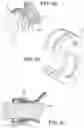 Fig. 08 - VENTING DEVICE