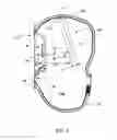Fig. 04 - Airbag module
