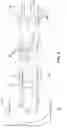 Fig. 06 - Method of tuning bending and torsion stiffness of ducted rotor core of an induction motor