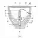 Fig. 02 - Explosion Protection System for a High Pressure Lamp