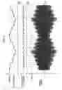 Fig. 17 - Discharge lamp lighting apparatus