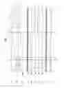 Fig. 04 - High-voltage discharge lamp lighting device and lighting fixture