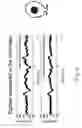 Fig. 07 - BIOSENSOR AND ELECTRODE STRUCTURE THEREOF