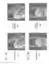 Fig. 14 - Magnetic resonance imaging apparatus and method