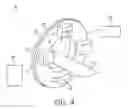 Fig. 04 - TRANSFORMER FOR A COMPUTER TOMOGRAPHY GANTRY
