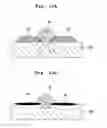Fig. 11 - Image recording apparatus