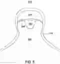 Fig. 09 - MAGNETIC WRITE HEADS FOR HARD DISK DRIVES AND METHOD OF FORMING SAME
