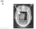 Fig. 01 - Accurate determination of the shape and localization of metallic object(s) in X-ray CT imaging