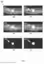 Fig. 07 - Accurate determination of the shape and localization of metallic object(s) in X-ray CT imaging