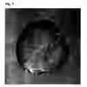 Fig. 04 - Au-Ga-In Brazing Material