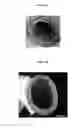 Fig. 02 - Process and reagents for the inhibition or reduction of scale formation during phosphoric acid production