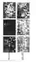 Fig. 122 - SPECIFIC BINDING PROTEINS AND USES THEREOF
