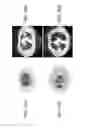 Fig. 151 - SPECIFIC BINDING PROTEINS AND USES THEREOF