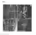 Fig. 03 - Human Neural Stem Cell and Pharmaceutical Composition for the Treatment of Central or Peripheral Nervous System Disorders or Injuries Using Same