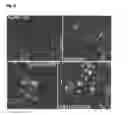 Fig. 04 - Human Neural Stem Cell and Pharmaceutical Composition for the Treatment of Central or Peripheral Nervous System Disorders or Injuries Using Same