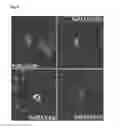 Fig. 05 - Human Neural Stem Cell and Pharmaceutical Composition for the Treatment of Central or Peripheral Nervous System Disorders or Injuries Using Same