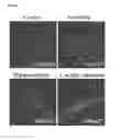 Fig. 10 - Human Neural Stem Cell and Pharmaceutical Composition for the Treatment of Central or Peripheral Nervous System Disorders or Injuries Using Same