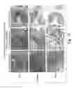 Fig. 13 - Methods of inhibiting unwanted cell proliferation using an antibody that binds to sonic hedgehog and inhibits hedgehog signaling
