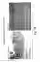 Fig. 17 - Methods of inhibiting unwanted cell proliferation using an antibody that binds to sonic hedgehog and inhibits hedgehog signaling