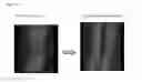 Fig. 33 - Mixed cell populations for tissue repair and separation technique for cell processing