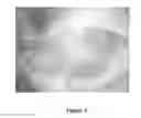 Fig. 04 - Stem cell cultivation devices and methods