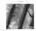 Fig. 08 - Negative active material for rechargeable lithium battery, method of preparing the same, and rechargeable lithium battery including the same