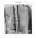 Fig. 11 - Negative active material for rechargeable lithium battery, method of preparing the same, and rechargeable lithium battery including the same