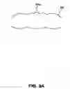 Fig. 06 - Activatable dental appliance