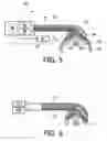 Fig. 05 - APPARATUS FOR CLEANING TEETH USING A VARIABLE FREQUENCY ULTRASOUND