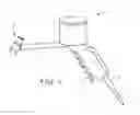 Fig. 02 - Powder jet device for applying dental material