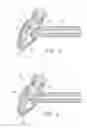 Fig. 04 - Powder jet device for applying dental material