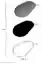 Fig. 06 - EYE PATCH KIT AND METHODS OF PROMOTING USE COMPLIANCE