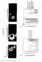 Fig. 09 - Methods for phenotyping of leukemias