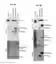 Fig. 14 - METHOD FOR DETECTION AND QUANTIFICATION OF PLK1 EXPRESSION AND ACTIVITY