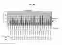 Fig. 22 - METHOD FOR DETECTION AND QUANTIFICATION OF PLK1 EXPRESSION AND ACTIVITY