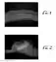 Fig. 02 - NOVEL ENHANCED FILAMENTOUS SILICONE PRODUCTS AND PROCESSES