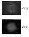 Fig. 05 - NOVEL ENHANCED FILAMENTOUS SILICONE PRODUCTS AND PROCESSES