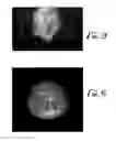 Fig. 06 - NOVEL ENHANCED FILAMENTOUS SILICONE PRODUCTS AND PROCESSES