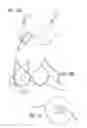 Fig. 12 - NOVEL ENHANCED FILAMENTOUS SILICONE PRODUCTS AND PROCESSES