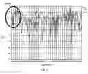 Fig. 06 - Vault antenna for WLAN or cellular application
