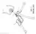 Fig. 06 - Swivel exerciser