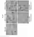 Fig. 06 - Method of treating pneumoconiosis with oligodeoxynucleotides