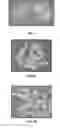 Fig. 02 - STAT3 inhibiting compositions and methods