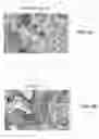 Fig. 10 - Inductive heating of tissues using alternating magnetic fields and uses thereof