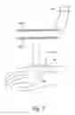 Fig. 07 - K-Ring electromagnetic treatment apparatus, system and method for tumors, arthritis and other ailments