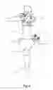 Fig. 04 - Surgical endoscope and process for exchanging surgical tools in a surgical endoscope