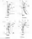 Fig. 44 - Fluid transfer system and method