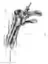 Fig. 02 - Electronic pelvic organ prolapse quantification system